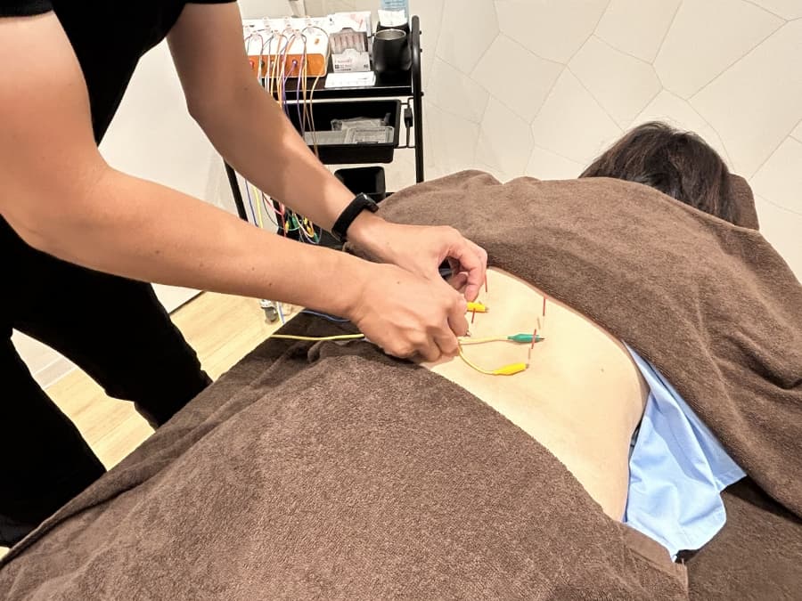 鍼灸マッサージイメージ